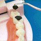 【Купете 1 и получете 1 безплатно】🦷Комплект клечки за зъби от неръждаема стомана